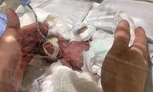 Bebeluș născut prematur