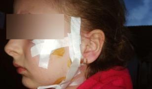 Fetiţă desfigurată de un câine în satul Laslea din Sibiu