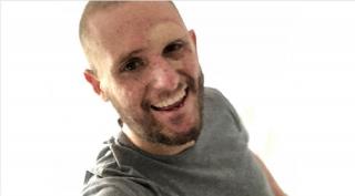 Josh a suferit zeci de tipuri de cancer de piele de-a lungul vieţii sale