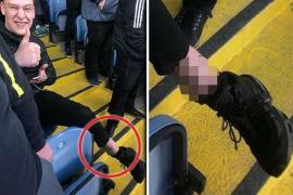 Dragostea pentru echipa favorită a fost mai mare decât un picior rupt