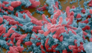 Elev diagnosticat cu tuberculoză