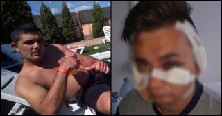 Amant bătut de soțul femeii infidele