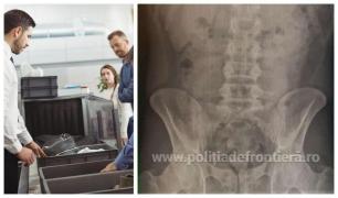 Tânăr prins în Aeroportul Otopeni cu cocaină în stomac. Poliţiştii au aşteptat 4 zile să elimine pachetele