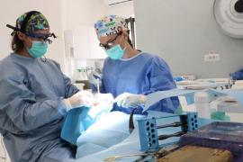 Cât rezistă un implant dentar?