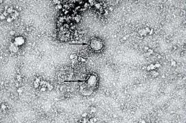 Imagini cu virusul care a ucis, până în prezent, 107 oameni şi a infectat peste 4.400