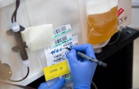 Un bărbat vindecat de Covid-19 a donat plasmă, apoi s-a infectat iar, cu alte simptome