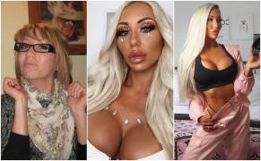 Transformarea unei tinere britanice în păpuşa Barbie, înainte şi după operaţii. Soţul ei este absolut încântat