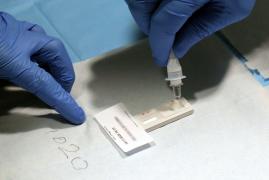 Managerul Institutului „Marius Nasta”: ”Oamenii știu că sunt bolnavi și se testează cu antigen, nu mai vin la spital”