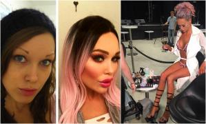 Tessa Texas înainte şi după operaţii