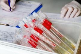 Ministrul Sănătății vrea testarea pentru coronavirus a tuturor cetățenilor din București