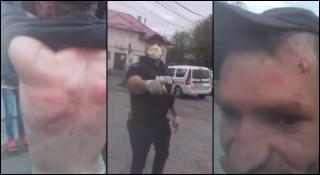 Polițiști din Vâlcea, cercetați pentru purtare abuzivă după o încătușare. Un bărbat ar fi fost bătut la secție