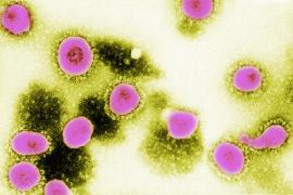 Particule moarte de COVID-19, responsabile pentru testele pozitive la pacienții vindecați