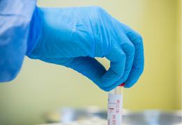 În jur de 31.000 de britanici au fost răpuși de coronavirus până acum