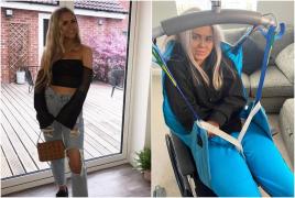 Lucy Corkeran înainte şi după accident