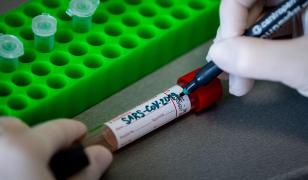 Coronavirus în România