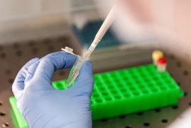 Bilant infectati de coronavirus în Romania, 2 iunie 2020