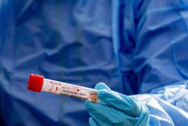 Bilant infectati coronavirus în Romania, 22 iunie 2020