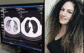 Anemona a murit din cauza COVID-19 deși nu suferea de alte boli