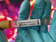 Bilanț coronavirus în România, 31 ianuarie: 1.825 cazuri şi 71 decese, în ultimele 24 de ore