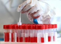 Bilanț coronavirus în România, 5 ianuarie