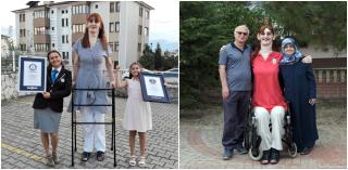 Cea mai înaltă femeie din lume, care are peste 2,15 metri, este din Turcia