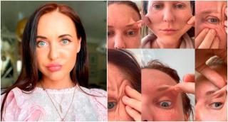 O femeie, care voia să arate mai tânără pentru fostul iubit, a rămas mutilată pe viaţă după un tratament cosmetic