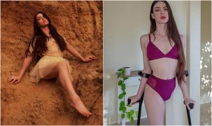 Cherie Louise, un model în vârstă de 29 de ani