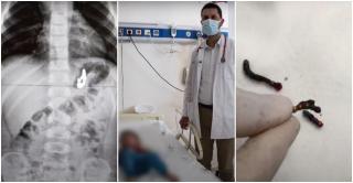 Băieţelul a fost operat de urgenţă