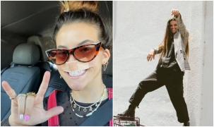 n model, căruia i-a fost smulsă buza superioară de un câine, povestește cum a trecut peste atacul îngrozitor