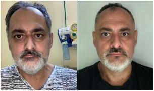 Viaţa după COVID. Mesajul emoţionant al unui fost pacient: "Un an de luptă pentru a reveni la cel ce am fost"