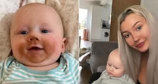 Raff Jozefiak bronzat pe jumătate din faţă şi mama lui Kenziah