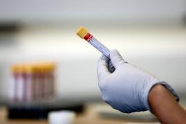 Cercetătorii francezi lucrează la un test Covid-19 pe bază de nanocorpi, rapid și cu o rată de precizie de 90%