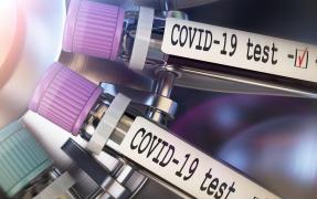 Bilanț coronavirus în România, 27 februarie. 3.432 de cazuri și 54 morți, în ultimele 24 de ore