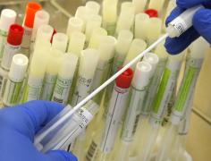 Varianta britanică a coronavirusului are o mortalitate dublă față de virusul original