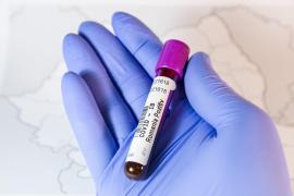 Bilanț coronavirus în România, 13 martie