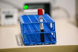 Tot mai mulți români vor testarea anticorpilor după vaccinare. Cum funcționează și cât costă testele neutralizante