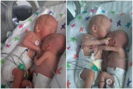 Prima îmbrățișare a unor gemeni, separați imediat după naștere. Mama era să-i piardă pe amândoi