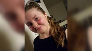 Emma Burkey a început să aibă convulsii la o săptămână după vaccinarea cu Johnson & Johnson