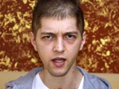 Coşmar fără sfârşit pentru Alexandru, un român de 23 de ani din Italia, care a rămas cu sechele după infecţia cu Covid