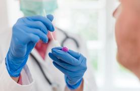 Doctor punând un test Covid19 în soluţie lichidă