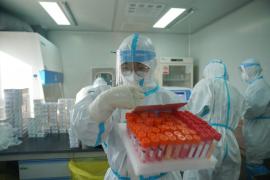 Anthony Fauci cere Chinei să publice dosarele medicale a nouă oameni. Ar putea oferi indicii vitale pentru elucidarea misterului apariției Covid