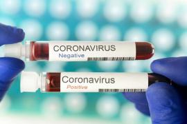 Bilanț coronavirus în România, 5 iunie. 35 de morţi şi 179 de cazuri, în ultimele 24 de ore