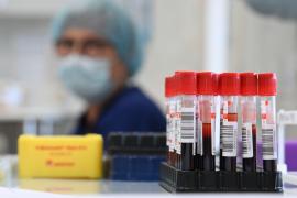 Numărul cazurilor de infectări cu tulpina Delta depistate în România a ajuns la 87. Trei persoane nevaccinate din Bacău și Argeș au murit