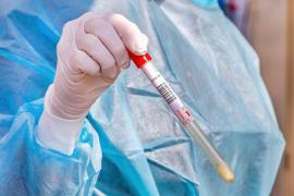 Test pentru depistarea coronavirus