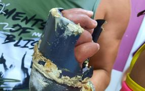 O fetiţă de cinci ani a rămas cu mâna blocată în tubul de evacuare al unei piscine, la un hotel din Mamaia