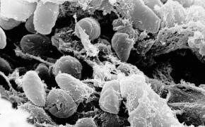 Imagine microscopică - ciumă