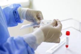 Bilanț coronavirus în România, 28 iulie.