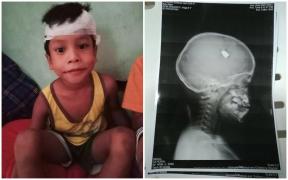 Adrian Lexter Pascua a fost operat pe creier pentru a fi scos glonțul care l-a lovit