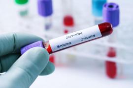 Test pentru depistarea coronavirus