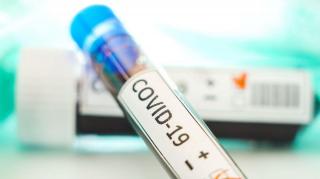 Test pentru depistarea coronavirus